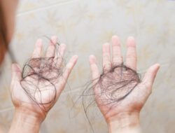 Dokter: Kerontokan Rambut Bisa Jadi Gejala Diabetes Tipe 2