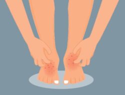 Tak Hanya Nyeri Dada, Ini Tiga Tanda Penyakit Jantung di Bagian Kaki