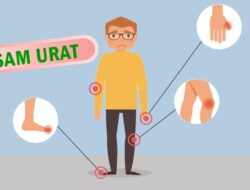 Lima Gejala Asam Urat di Usia Muda yang Sering Disepelekan