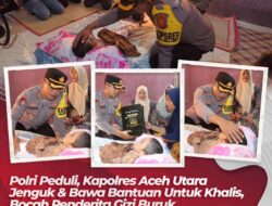 Polri Peduli, Kapolres Aceh Utara Jenguk dan Bawa Bantuan untuk Khalis, Bocah Penderita Gizi Buruk.