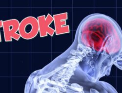Waspada, Remaja Putri Obesitas Beresiko Terkena Stroke di Usia 55 Tahun