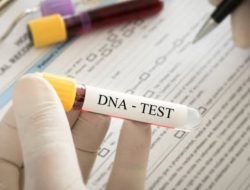 Besok Bareskrim Terima Hasil Tes DNA RK dan Anak Lisa